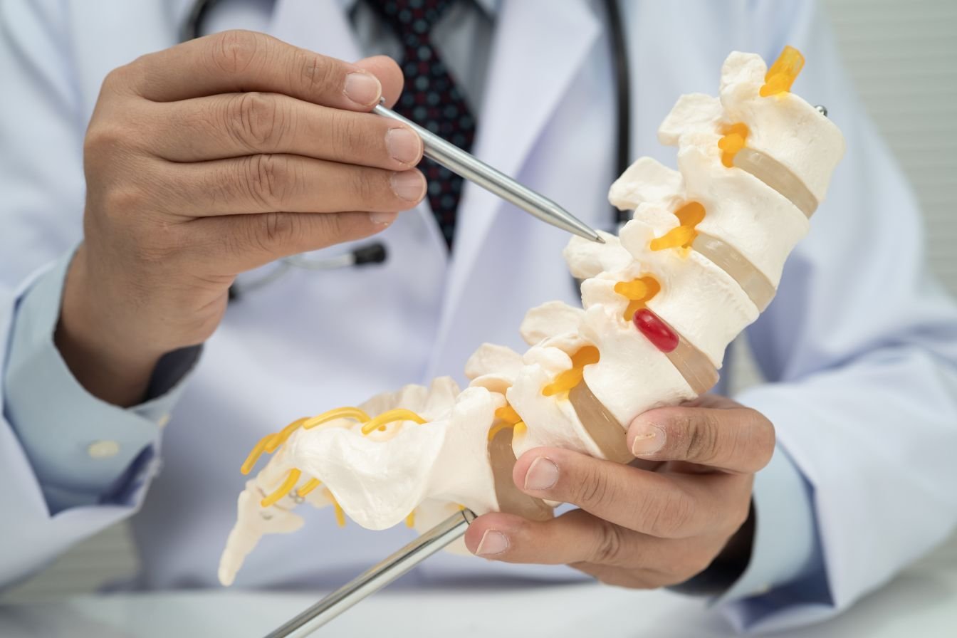 Sciatica Treatment Indore