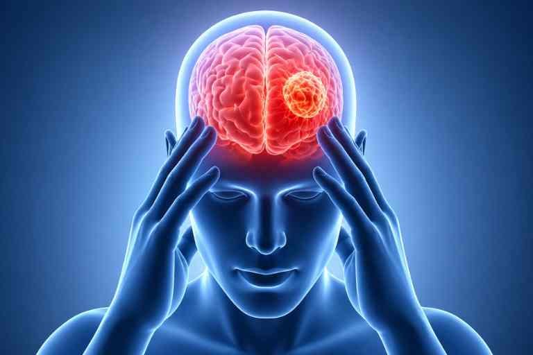 Brain Surgery Indore